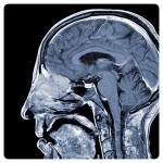 Craniofacial scan