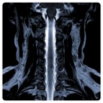 Spine myelography