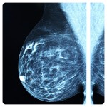 Breast scan