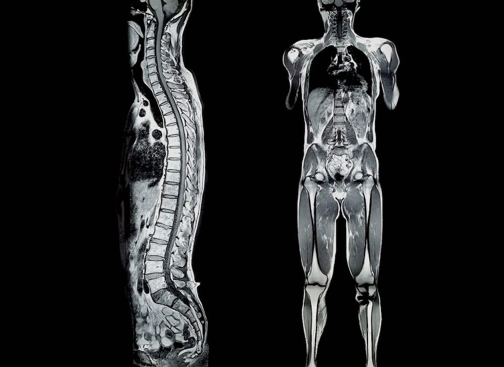 obraz przedstawiający badanie rezonansem całego ciała